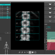 Moc Eurotec Medical System DENSITY